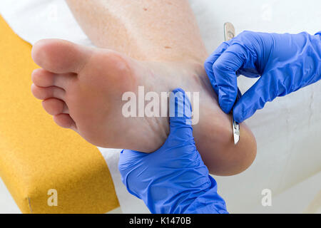 Donna podologia ricevente il trattamento- podiatrist pedicure pulizia piedi womans Foto Stock