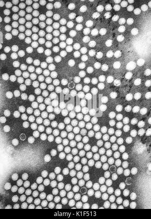 Micrografia elettronica di poliovirus. Il poliovirus è una specie di enterovirus, che è un genere nella famiglia dei Picornaviridae, ed è un virus di RNA. Immagine cortesia CDC/Dott. Fred Murphy, Sylvia Whitfield, 1975. Foto Stock