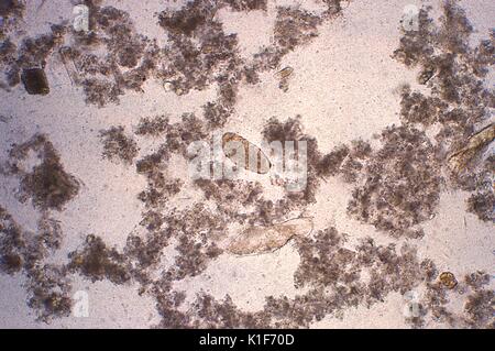 Ingrandito 128X, questo fotomicrografia ha rivelato alcune delle caratteristiche ultrastrutturali visualizzate da un infertile, Ascaris lumbricoides uovo. Fecondato non fecondato e A. lumbricoides uova sono passati nelle feci degli host infetti. Le uova fecondate sono arrotondati e hanno un guscio spesso con un esterno mammillated strato che è spesso macchiato da marrone bile. In alcuni casi, lo strato esterno è assente (noto come sgusciati uova). Uova fertile campo da 45{micro}m a 75{micro}m in lunghezza. Uova non fecondate sono allungate e maggiore di uova fertili (fino a 90{micro}m di lunghezza). Il loro guscio è thinn Foto Stock