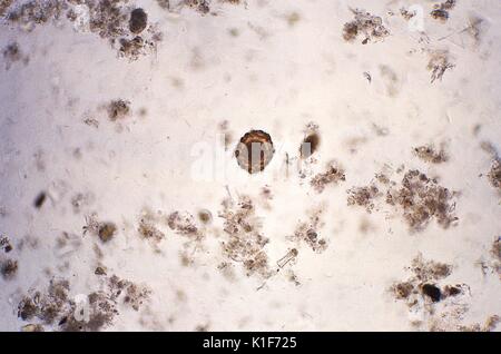 Ingrandito 128X, questo fotomicrografia ha rivelato alcune delle caratteristiche ultrastrutturali visualizzato da una fertile Ascaris lumbricoides uovo. A. lumbricoides è il più grande nematode (nematode) parasitizing l'intestino umano. Fecondato non fecondato e Ascaris lumbricoides uova sono passati in uno sgabello del host infetti. Le uova fecondate sono arrotondati e hanno un guscio spesso con un esterno mammillated strato che è spesso macchiato da marrone bile. In alcuni casi, lo strato esterno è assente (noto come sgusciati uova). Uova fertile campo da 45 a 75 {micro}m in lunghezza. Uova non fecondate sono allungate e Foto Stock