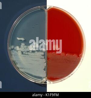 Agar di Sangue e bicarbonato piastra di agar di colture di Bacillus cereus, negativo test di incapsulamento ruvida di colonie di Bacillus cereus su entrambi il sangue ed il bicarbonato agars Immagine cortesia CDC/Dr James Feeley, 1980. Foto Stock