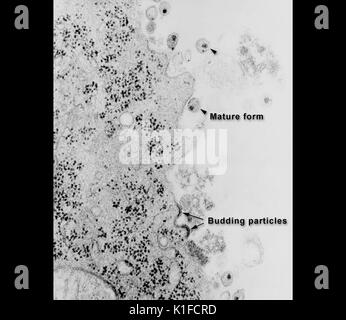 Questo microscopio elettronico a trasmissione (TEM) raffigura l'HIV-1 germogliando e libera i virioni. Immagine cortesia CDC/Alyne Harrison, Erskine Palmer, Paolo Feorino, 1984. Foto Stock