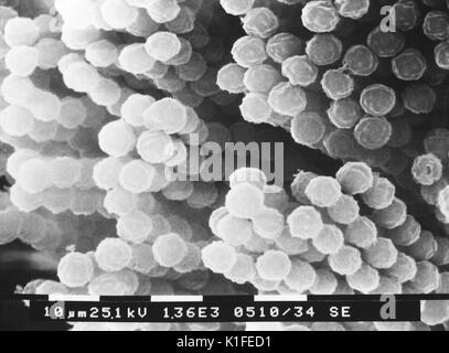 Questo scanning electron microfotografia (SEM) raffigura numero di catene di specie Aspergillus conidiospores fungina. Per una versione colorato di questa immagine, vedere PHIL 13368. Aspergillus è un fungo (o) dello stampo che è molto comune nell'ambiente. Si è trovato in suolo, sulle piante e nel decadimento di materia vegetale. Si è anche trovato nella polvere domestica, materiali da costruzione e anche nelle spezie e alcuni cibi. Ci sono un sacco di tipi diversi di Aspergillus, ma i più comuni sono quelle di Aspergillus fumigatus e Aspergillus flavus . Alcuni altri sono Aspergillus terreus, Aspergillus nidulans e Aspergillus nig Foto Stock