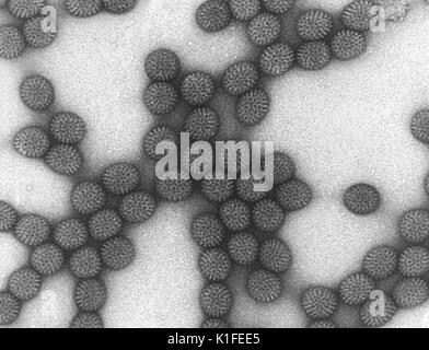 Sotto un elevato ingrandimento di 446, 428X, questo negativamente macchiate di microscopio elettronico a trasmissione (TEM) ha rivelato alcuni della morfologia ultrastrutturale visualizzati da numeri di particelle di rotavirus. Un Reoviridae membro della famiglia con un RNA nucleo circondato da una a tre strati icosaedrico capside proteico, il rotavirus è non avvolto e misure 76.5nm in diametro. Il rotavirus è un virus che provoca la gastroenterite (infiammazione di stomaco e intestino). La malattia di rotavirus provoca grave diarrea, spesso con vomito, febbre e dolore addominale. In neonati e bambini piccoli, può lea Foto Stock