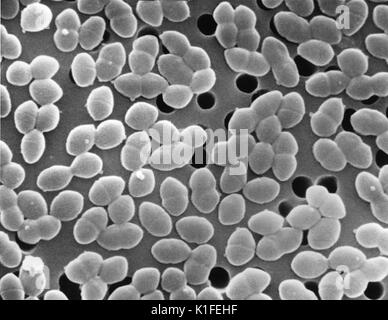 Questo scanning electron microfotografia (SEM) rappresentato il numero di batteri, che sono stati identificati come i batteri Gram-positivi Enterococcus sp. batteri. Identificato in precedenza come "gruppo D' Streptococcus organismi, la maggior parte clinicamente rilevanti di questi batteri sono, E. faecalis e E. faecium . Enterococcus spp. batteri sono notoriamente legato come agenti eziologici responsabili nosocomiche, o 'ospedale-borne" patologie, come ad esempio "enterococchi resistenti alla vancomicina', o infezioni da VRE. Questi organismi sono "commensali' in natura, il che significa che di norma essi colonizzano il tubo digerente umano e diventare pat Foto Stock