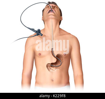 Esame dell'interno di un organo o di una cavità utilizzando un endoscopio. Foto Stock