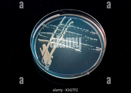 Pila piastra petri con colture di microrganismi in mano medico , funghi e microbi. Una capsula di Petri ( Petrie piatto. La piastra di Petri o di coltura cellulare Foto Stock