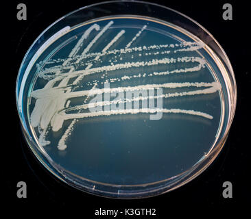 Pila piastra petri con colture di microrganismi in mano medico , funghi e microbi. Una capsula di Petri ( Petrie piatto. La piastra di Petri o di coltura cellulare Foto Stock