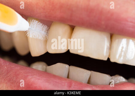 Close-up di un uomo che pulisce i denti Foto Stock