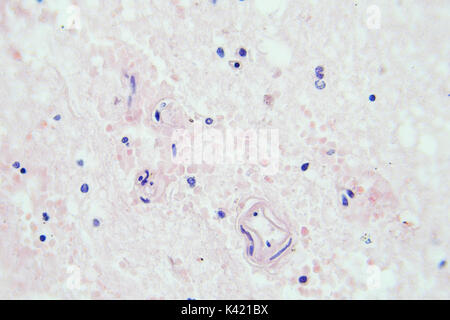 Il tessuto del cervello microscopiche di ingrandimento vista x400 Foto Stock