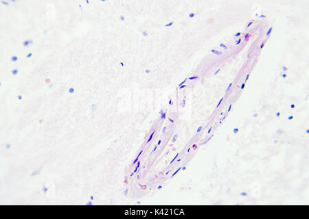 Il tessuto del cervello microscopiche di ingrandimento vista x400 Foto Stock