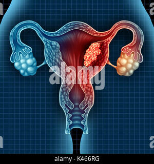 Utero cancro endometriale e tumore maligno come uterina concetto medico come pericolosi crescere le cellule in un corpo femmina di attaccare il sist riproduttiva Foto Stock