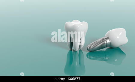 Dente e impianto dentale isolato su sfondo verde. 3d illustrazione Foto Stock