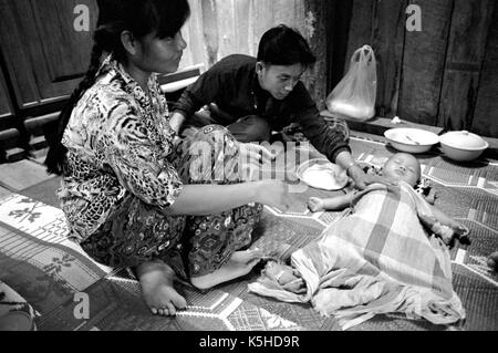 Thai medici su un bambino muore di malaria cerebrale a Medècins Sans Frontières ospedale in Mawker rifugiati birmani camp nel nord-ovest della Thailandia. Settembre, 1996. Foto Stock