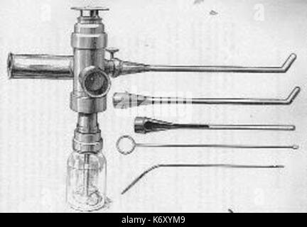Endoscopio de Desormeaux Foto Stock