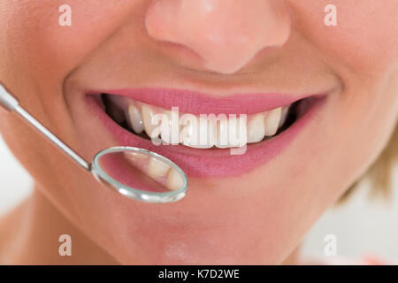 Close-up di donna con denti bianchi e specchio di dentista Foto Stock