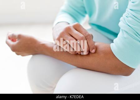 Donna di graffiare il braccio. Foto Stock