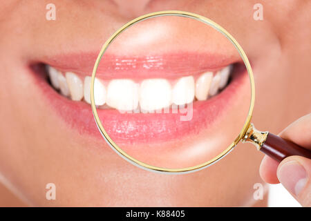 Close-up di denti femmina controllato dal medico con lente di ingrandimento Foto Stock