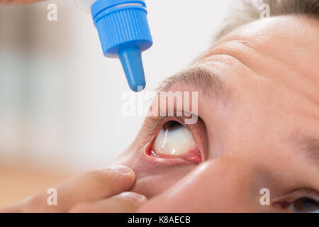 Close-up di giovane uomo versando gocce di medicina nei suoi occhi Foto Stock