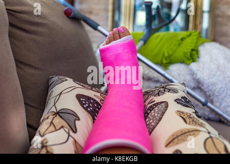 Donna con la gamba rotta gamba rotta in rosa calco in gesso in appoggio su un pullman Foto Stock