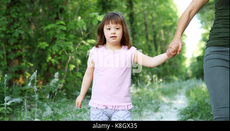 Ritratto di bella bambina con la sindrome di down Foto Stock