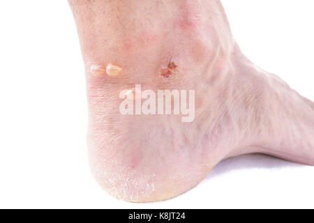 Primo piano della caviglia con alveoli Foto Stock