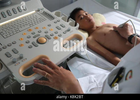 Duc Tam heart hospital. ecocardiogramma doppler. Ho chi minh city. Vietnam. Foto Stock