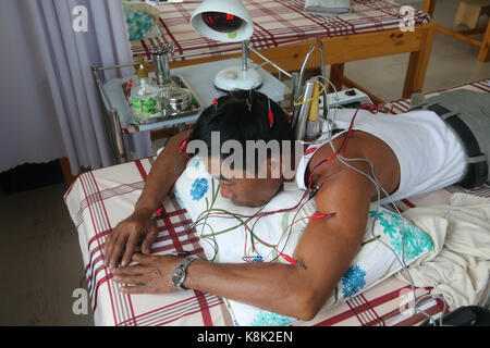 Clinica di medicina tradizionale vietnamita. Agopuntura. cu chi. vietnam. Foto Stock