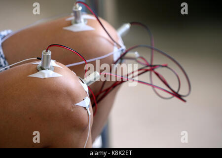 Clinica di medicina tradizionale vietnamita. Agopuntura. cu chi. vietnam. Foto Stock