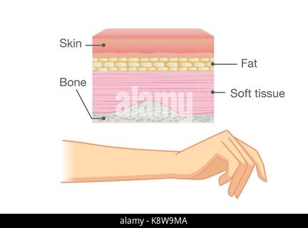 Anatomia della pelle umana strato e braccio. Illustrazione Vettoriale