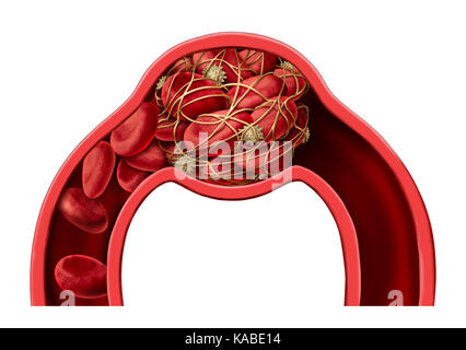 Di coagulo di sangue simbolo della malattia e trombosi medical 3d illustrazione nozione come un gruppo di cellule del sangue umano ammassate insieme da piastrine appiccicosa. Foto Stock