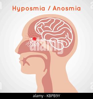 E hyposmia anosmia logo icona vettore illustrazione design Illustrazione Vettoriale