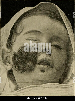 "Le malattie dei neonati e dei bambini" (1919) Foto Stock