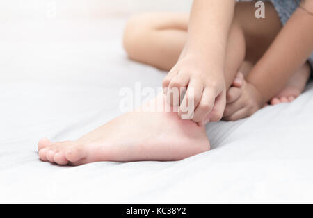 Ragazza graffiare il prurito con mano sul letto, health care concept Foto Stock