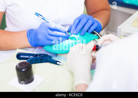 Close-up di una giovane donna dentista in bianco uniforme medica e la sua assistente effettuare una procedura di sbianca e la pulizia dei denti da una placca in un moderno d Foto Stock