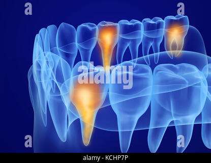 Bocca gengive e denti vista a raggi x. Accurata dal punto di vista medico dente 3D illustrazione Foto Stock