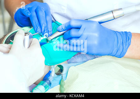 Un close-up del dentista e la sua assistente giacciono denti per il bambino con l aiuto di un trapano, effettuare le procedure di trattamento contro la carie dentaria e plaq Foto Stock