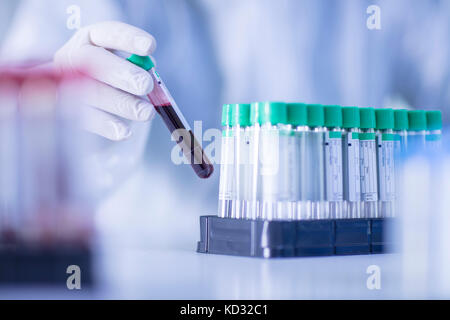 Lavoratore di laboratorio immissione riempita di liquido tubo di prova in rack. close-up Foto Stock