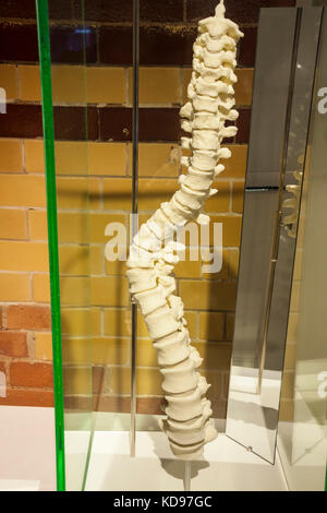 Ricostruzione della colonna vertebrale curva di RichardIII in mostra a Leicester, Inghilterra, Regno Unito Foto Stock