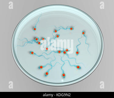 La fecondazione in vitro concetto. Computer illustrazione che mostra spermatozoans in una capsula di petri in attesa di essere usato per fertilizzare una cellula uovo. Foto Stock