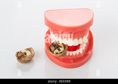 Modello dentale della ganascia Foto Stock
