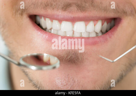 Close-up di giovane uomo esaminando i suoi denti Foto Stock