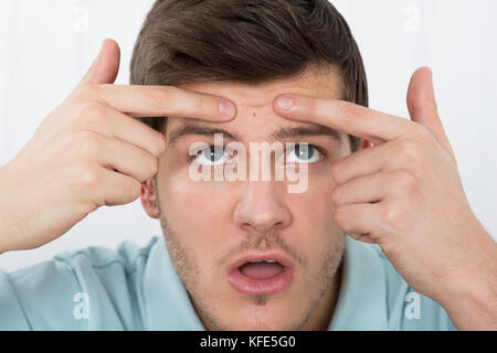 Scioccato giovane uomo guardando il brufolo sulla fronte Foto Stock