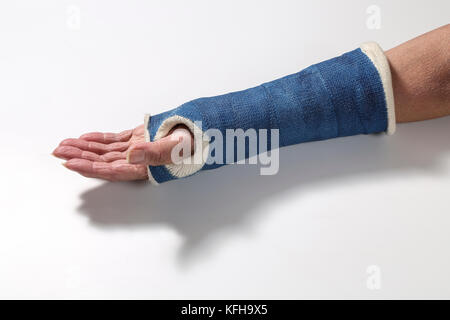 Onorevoli braccio con la rottura di un polso con una pentola a. Foto Stock