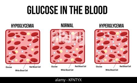 I livelli di glucosio nel sangue diagramma, illustrazione vettoriale (di base per l'istruzione medica, per cliniche e scuole) Illustrazione Vettoriale