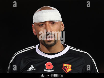 Il portiere di Watford Heurelho Gomes riceve un trattamento dopo aver subito un danno alla testa durante la partita della Premier League al Goodison Park, Liverpool. PREMERE ASSOCIAZIONE foto. Data immagine: Domenica 5 novembre 2017. Vedi PA storia CALCIO Everton. Il credito fotografico dovrebbe essere: Peter Byrne/PA Wire. RESTRIZIONI: SOLO USO EDITORIALE non utilizzare con audio, video, dati, elenchi di apparecchi, logo di club/campionato o servizi "live" non autorizzati. L'uso in-match online è limitato a 75 immagini, senza emulazione video. Nessun utilizzo nelle scommesse, nei giochi o nelle pubblicazioni di singoli club/campionati/giocatori. Foto Stock