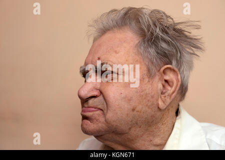 Anziani inglesi uomo con due tipo di diabete Foto Stock