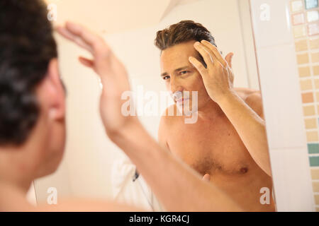 Uomo di mezza età in questione con la perdita dei capelli Foto Stock