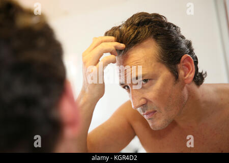 Uomo di mezza età in questione con la perdita dei capelli Foto Stock