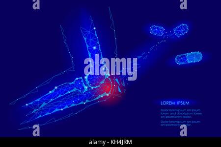 Capsula di farmaco cura il giunto a gomito malattia. rosso area dolore bassa poli geomentic medicina del futuro concetto di tecnologia. innovazione scienza della medicina. braccio lesioni ulna connessione poligonale illustrazione vettoriale Illustrazione Vettoriale